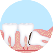 ортодонтические проблемы